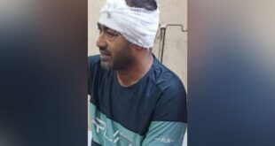 জাসদের রাজনীতি ছাড়া সাবেক মেয়রের ওপর হামলা, মাথায় ১১ সেলাই