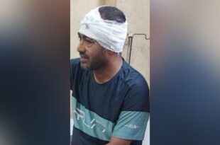 জাসদের রাজনীতি ছাড়া সাবেক মেয়রের ওপর হামলা, মাথায় ১১ সেলাই