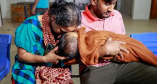 হামের উপসর্গে আরও ৬ জনের মৃত্যু, মোট মৃত্যু ৮১৬