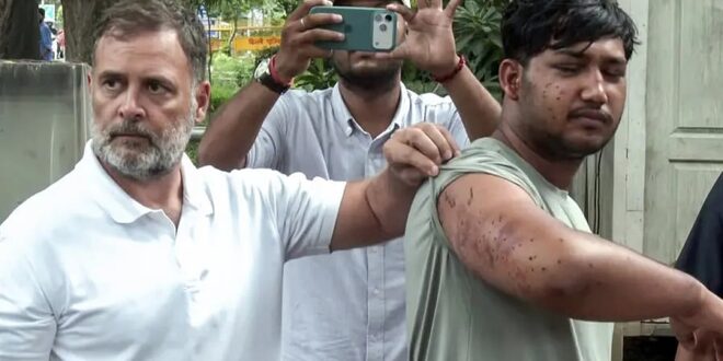 নিরাপত্তা বাহিনীর সদস্য ছররা গুলি ছুড়েছেন, প্রশ্ন উঠেছে কার আদেশে গুলি হলো