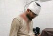 সোহরাওয়ার্দী কলেজের সামনে জকসুর স্বাস্থ্য সম্পাদক নূর মোহাম্মদের ওপর হামলা