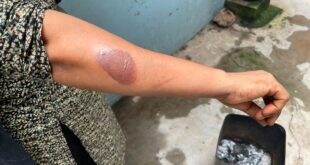‘ডিমটা পর্যন্ত ভাজা যায় না, চিড়া–কলা খায়া থাকতে হয়’