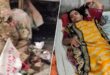 ঘরের পাশে বালুভর্তি বস্তায় হঠাৎ বিস্ফোরণ, শিশুসহ দগ্ধ ৩